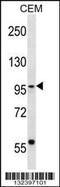 SEC63 Homolog, Protein Translocation Regulator antibody, 56-867, ProSci, Western Blot image 