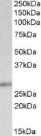 Cyclin Dependent Kinase Inhibitor 1B antibody, STJ70026, St John
