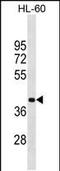 Methyl-CpG Binding Domain Protein 2 antibody, PA5-35233, Invitrogen Antibodies, Western Blot image 