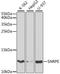 Small Nuclear Ribonucleoprotein Polypeptide E antibody, STJ27441, St John