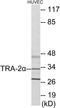 Transformer 2 Alpha Homolog antibody, EKC1803, Boster Biological Technology, Western Blot image 