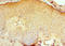 CD1a Molecule antibody, LS-C375413, Lifespan Biosciences, Immunohistochemistry paraffin image 