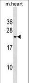 Triggering Receptor Expressed On Myeloid Cells 2 antibody, LS-C158280, Lifespan Biosciences, Western Blot image 