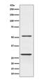 Parkin RBR E3 Ubiquitin Protein Ligase antibody, M00127, Boster Biological Technology, Western Blot image 