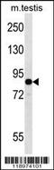 Eukaryotic Translation Initiation Factor 2B Subunit Epsilon antibody, MBS9201029, MyBioSource, Western Blot image 