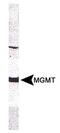 O-6-Methylguanine-DNA Methyltransferase antibody, MA3-16537, Invitrogen Antibodies, Western Blot image 