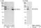 Transient Receptor Potential Cation Channel Subfamily C Member 6 antibody, NBP1-52635, Novus Biologicals, Western Blot image 