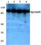 Anion exchange protein 4 antibody, PA5-37127, Invitrogen Antibodies, Western Blot image 