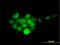 Proteasome 26S Subunit, Non-ATPase 14 antibody, H00010213-M01, Novus Biologicals, Immunofluorescence image 
