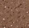 Methylcrotonoyl-CoA Carboxylase 1 antibody, NBP1-81254, Novus Biologicals, Immunohistochemistry paraffin image 