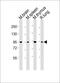 Mediator Complex Subunit 15 antibody, M03568-1, Boster Biological Technology, Western Blot image 