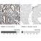 Polybromo 1 antibody, NBP2-30673, Novus Biologicals, Immunohistochemistry paraffin image 