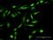 Gem Nuclear Organelle Associated Protein 7 antibody, H00079760-D01P, Novus Biologicals, Immunocytochemistry image 