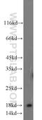 Gamma-Glutamylamine Cyclotransferase antibody, 23280-1-AP, Proteintech Group, Western Blot image 