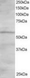 Oxysterol-binding protein-related protein 2 antibody, TA302904, Origene, Western Blot image 