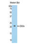 Collagen Type VI Alpha 1 Chain antibody, LS-C304654, Lifespan Biosciences, Western Blot image 