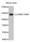 Glutamate Ionotropic Receptor NMDA Type Subunit 1 antibody, STJ22157, St John