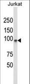 Phospholipase C Like 1 (Inactive) antibody, LS-C163778, Lifespan Biosciences, Western Blot image 