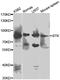 Bruton Tyrosine Kinase antibody, MBS127630, MyBioSource, Western Blot image 
