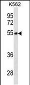 Testin antibody, PA5-49265, Invitrogen Antibodies, Western Blot image 