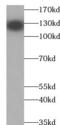 Platelet And Endothelial Cell Adhesion Molecule 1 antibody, FNab01463, FineTest, Western Blot image 