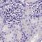 DHEA-ST antibody, NBP2-32604, Novus Biologicals, Immunohistochemistry frozen image 