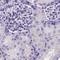 Sulfotransferase Family 2A Member 1 antibody, NBP2-32604, Novus Biologicals, Immunohistochemistry frozen image 