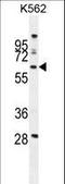 WD Repeat Domain 49 antibody, LS-C160590, Lifespan Biosciences, Western Blot image 