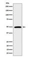 STAM Binding Protein antibody, M05964, Boster Biological Technology, Western Blot image 