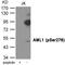 RUNX Family Transcription Factor 1 antibody, GTX55409, GeneTex, Western Blot image 