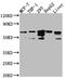 Fatty Acid Amide Hydrolase antibody, CSB-RA560252A0HU, Cusabio, Western Blot image 