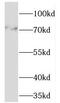 Transmembrane And Coiled-Coil Domain Family 1 antibody, FNab08735, FineTest, Western Blot image 