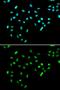 SWI/SNF-related matrix-associated actin-dependent regulator of chromatin subfamily A containing DEAD/H box 1 antibody, GTX32882, GeneTex, Immunofluorescence image 