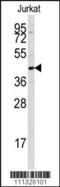 Protein Tyrosine Phosphatase Non-Receptor Type 7 antibody, 63-024, ProSci, Western Blot image 