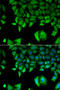 Interleukin 17F antibody, STJ28570, St John