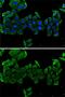 Cartilage Oligomeric Matrix Protein antibody, GTX33106, GeneTex, Immunofluorescence image 
