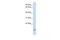 Zymogen Granule Protein 16 antibody, A09278, Boster Biological Technology, Western Blot image 