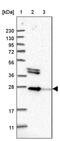 Osteoclast Stimulating Factor 1 antibody, PA5-54224, Invitrogen Antibodies, Western Blot image 
