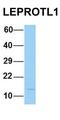 Leptin Receptor Overlapping Transcript Like 1 antibody, orb326676, Biorbyt, Western Blot image 