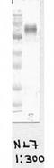 Spectrin Repeat Containing Nuclear Envelope Protein 1 antibody, orb76724, Biorbyt, Western Blot image 