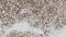 CD1a Molecule antibody, GTX01899, GeneTex, Immunohistochemistry paraffin image 