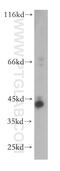 Trimethyllysine Hydroxylase, Epsilon antibody, 16621-1-AP, Proteintech Group, Western Blot image 