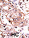 Protein Phosphatase 2 Catalytic Subunit Alpha antibody, 63-484, ProSci, Immunohistochemistry paraffin image 