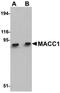MET Transcriptional Regulator MACC1 antibody, orb75211, Biorbyt, Western Blot image 
