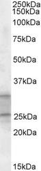 Protein cousin-of-RKIP 1 antibody, EB09427, Everest Biotech, Western Blot image 