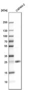 Transmembrane emp24 domain-containing protein 7 antibody, PA5-52634, Invitrogen Antibodies, Western Blot image 