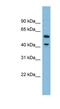 Dihydrouridine Synthase 1 Like antibody, NBP1-57743, Novus Biologicals, Western Blot image 