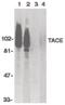ADAM Metallopeptidase Domain 17 antibody, PA5-19872, Invitrogen Antibodies, Western Blot image 