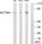 Actinin Alpha 1 antibody, abx013893, Abbexa, Western Blot image 