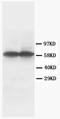 Tyrosine Hydroxylase antibody, AM20681PU-N, Origene, Western Blot image 